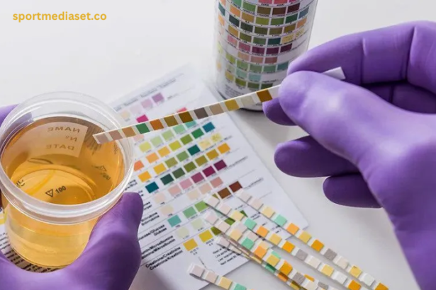 Cocaine and Urine Testing: A Comprehensive Look at Detection Times